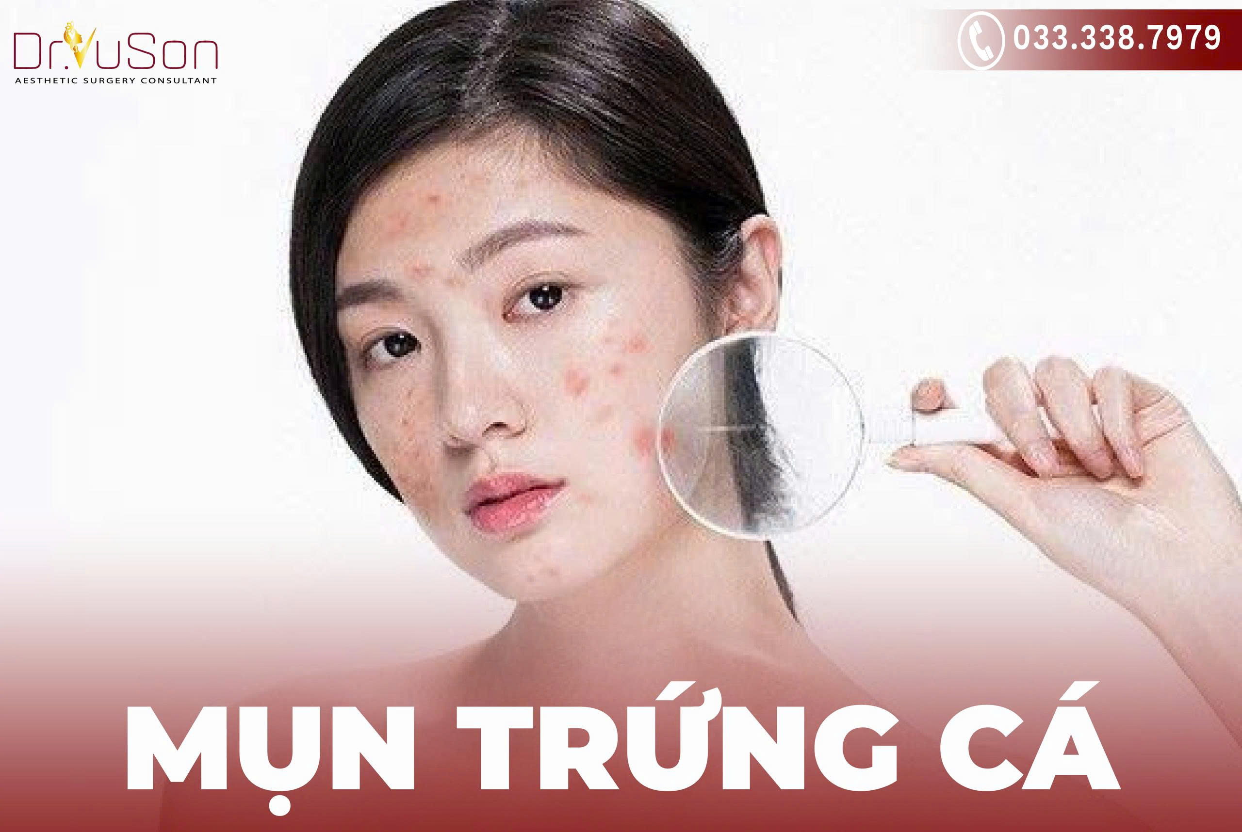 Mụn trứng cá xuất hiện trên mặt ở nhiều dạng khác nhau