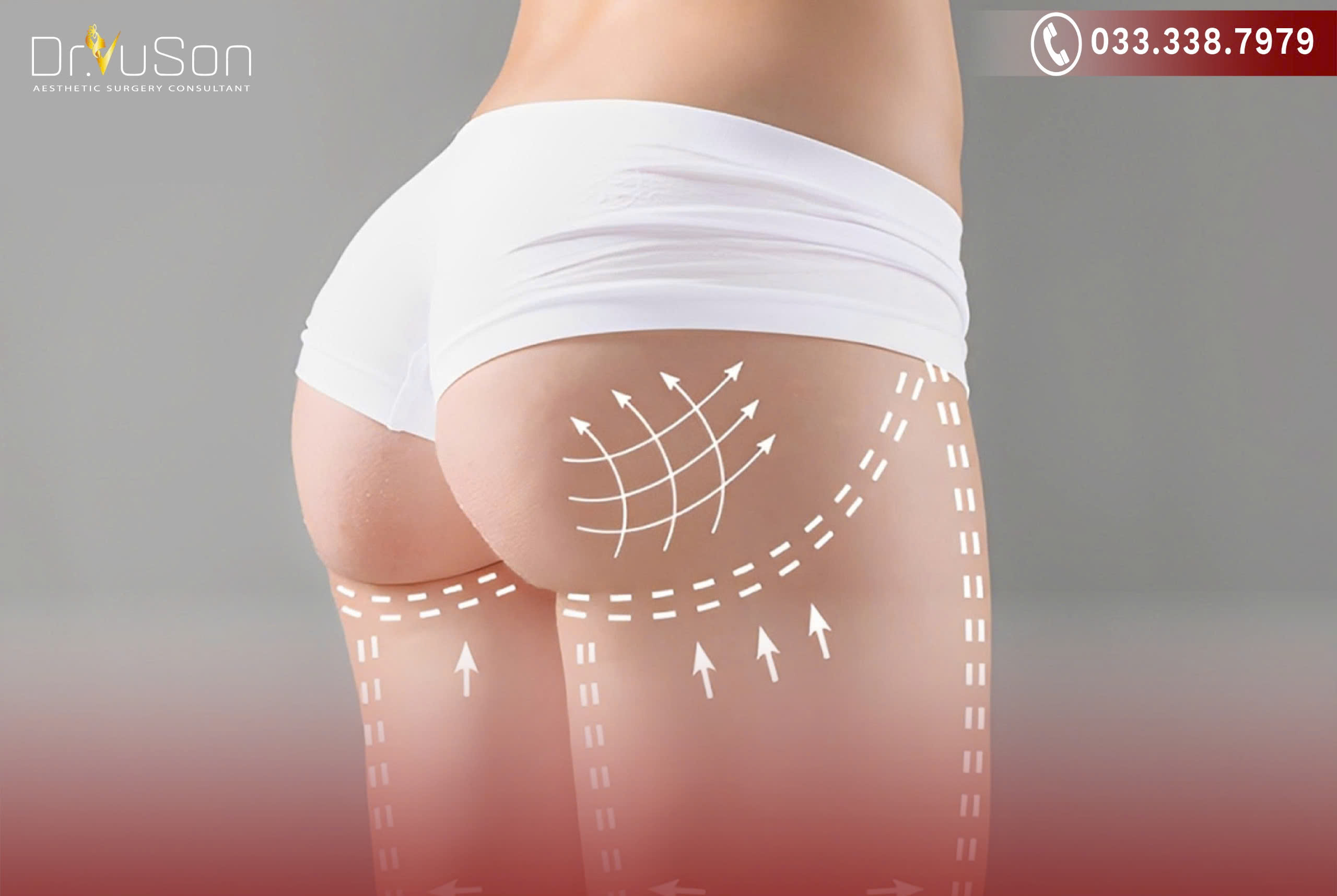 Chọn giải pháp thông minh để sở hữu vòng 3 mơ ước một cách an toàn