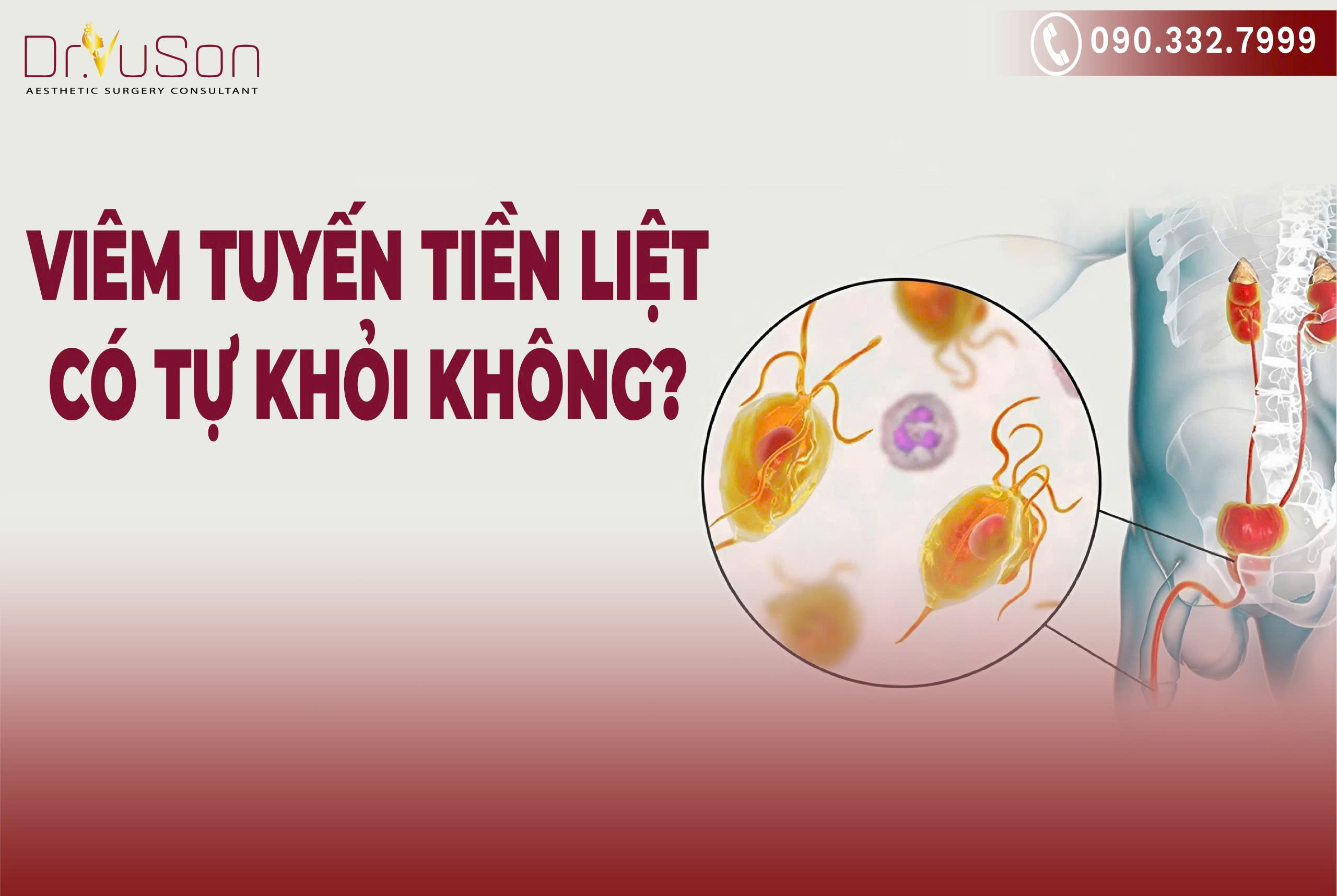 Viêm tuyến tiền liệt có tự khỏi không?