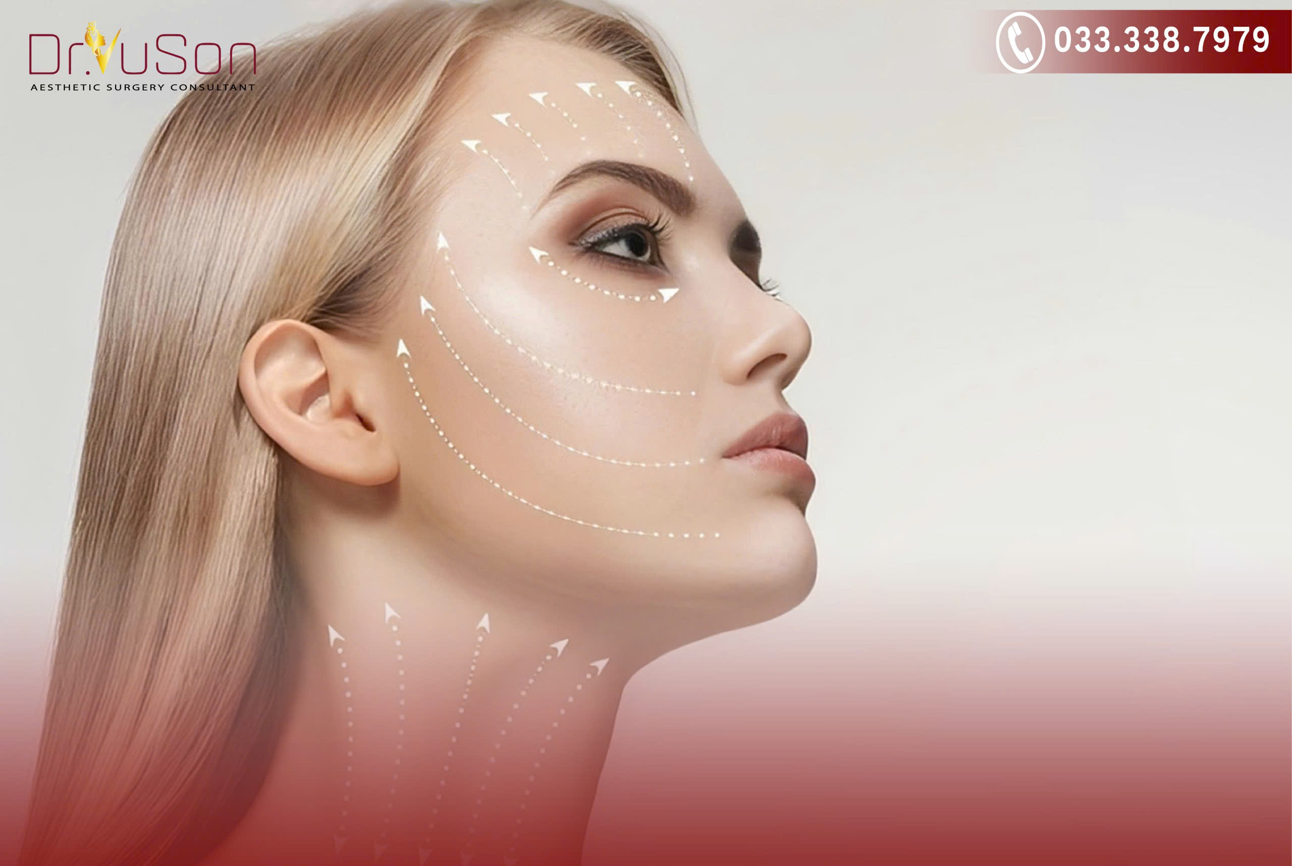 Căng chỉ Collagen có tác dụng phụ không?
