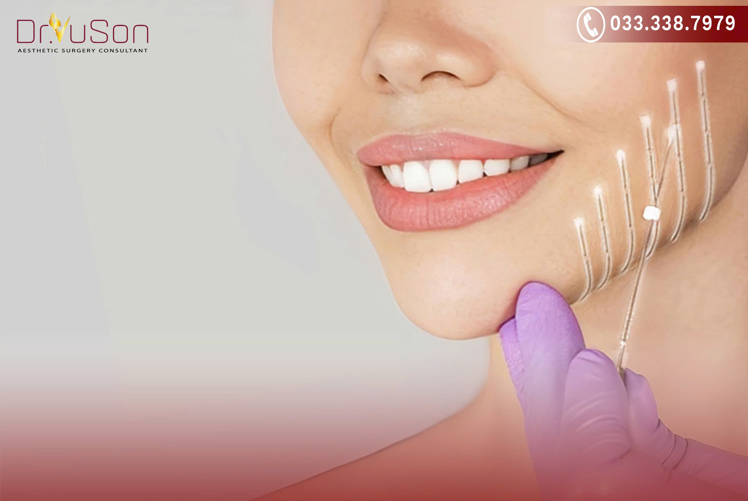 Các sợi chỉ sinh học đóng vai trò như một khung giá đỡ dưới da