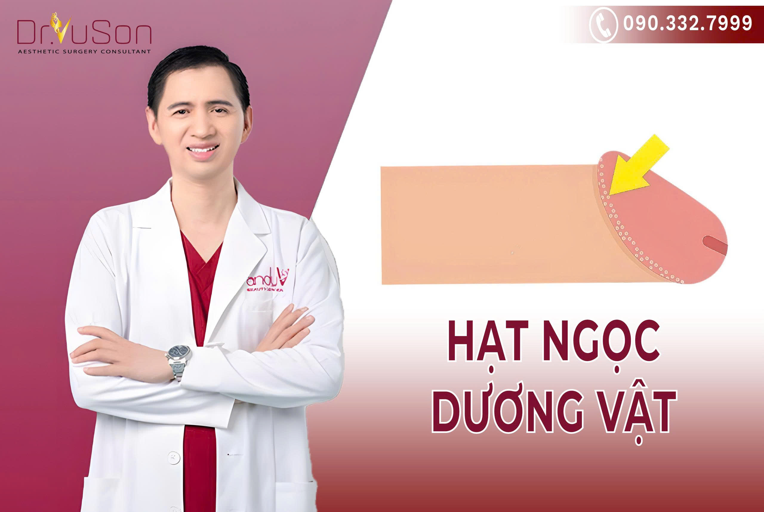 Hạt ngọc dương vật là nốt sần màu trắng hoặc hồng mọc thành hàng quanh đầu dương vật