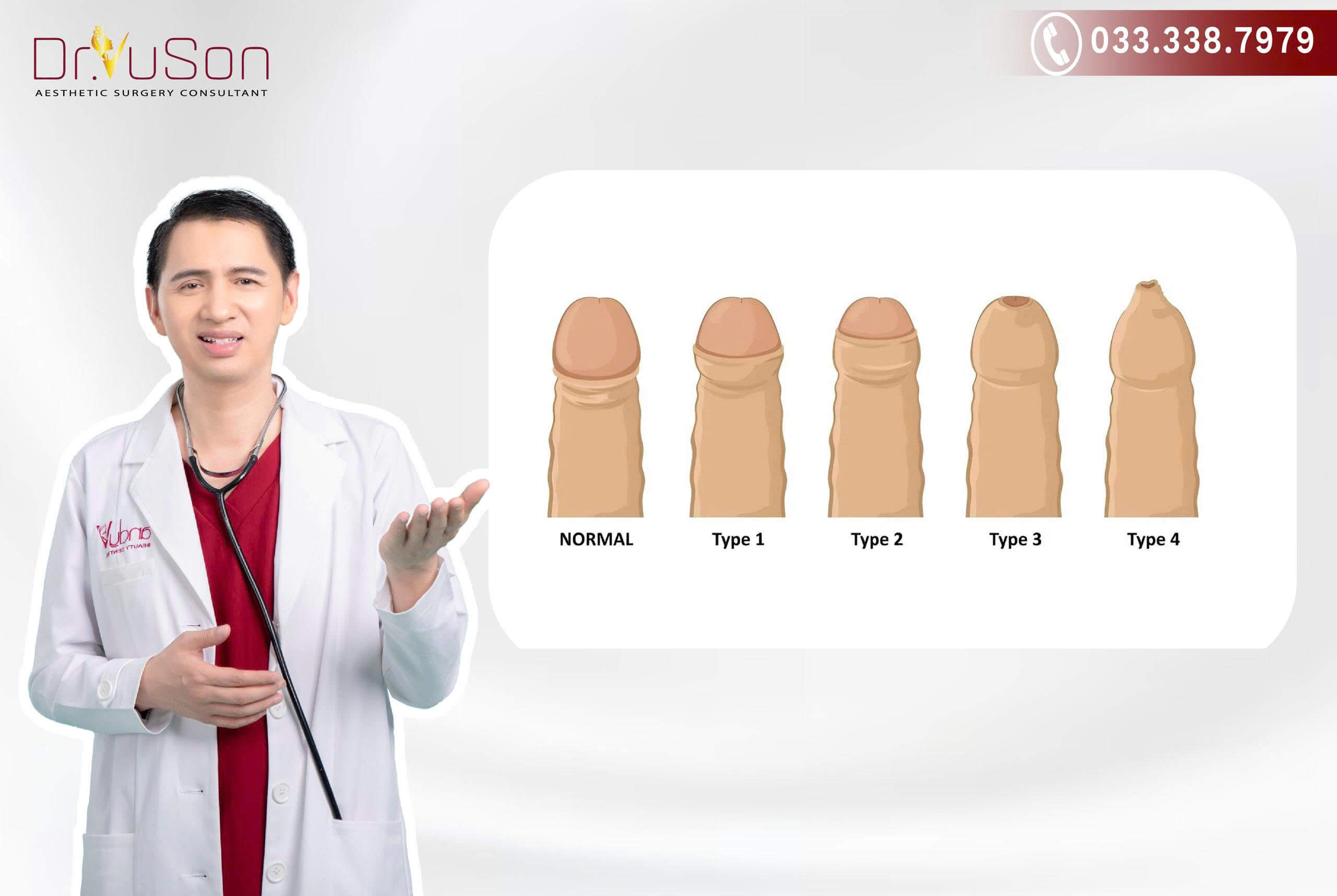 Nếu bao quy đầu không tự tuột xuống được sẽ khó phát triển về chiều dài