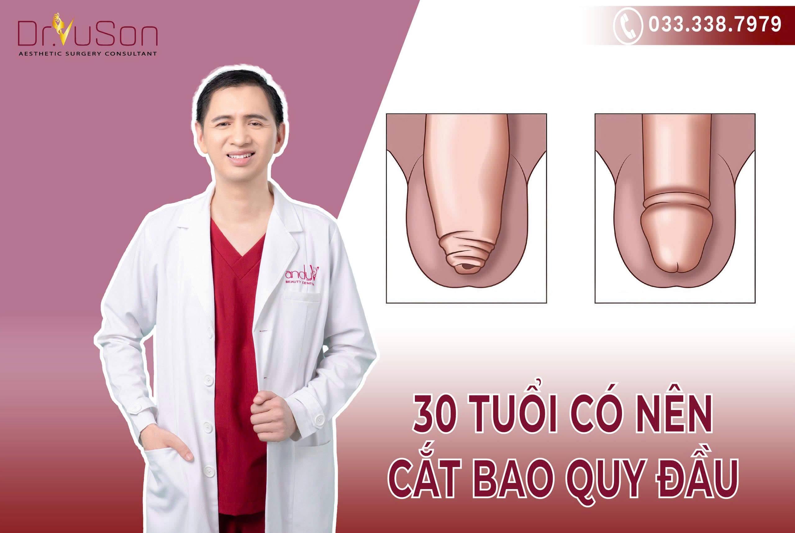 Giải đáp thắc mắc đàn ông 30 tuổi có nên cắt bao quy đầu hay không và lợi ích mang lại