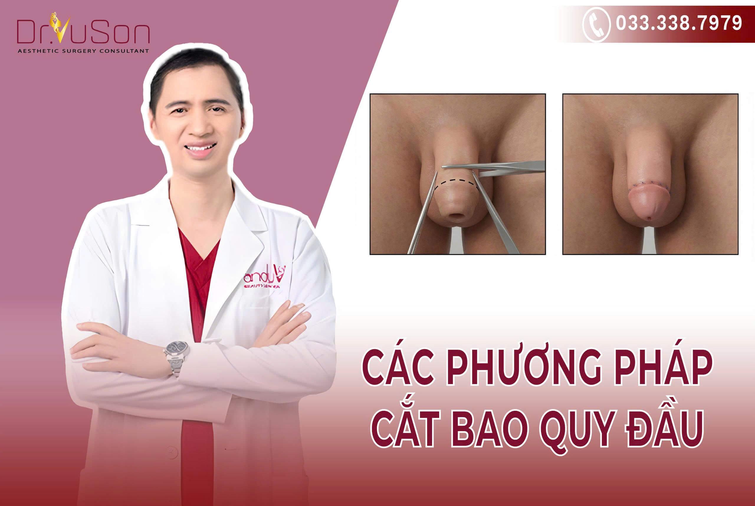 Bác sĩ nam khoa đang tư vấn chi tiết về các phương pháp cắt bao quy đầu cho bệnh nhân để lựa chọn giải pháp phù hợp