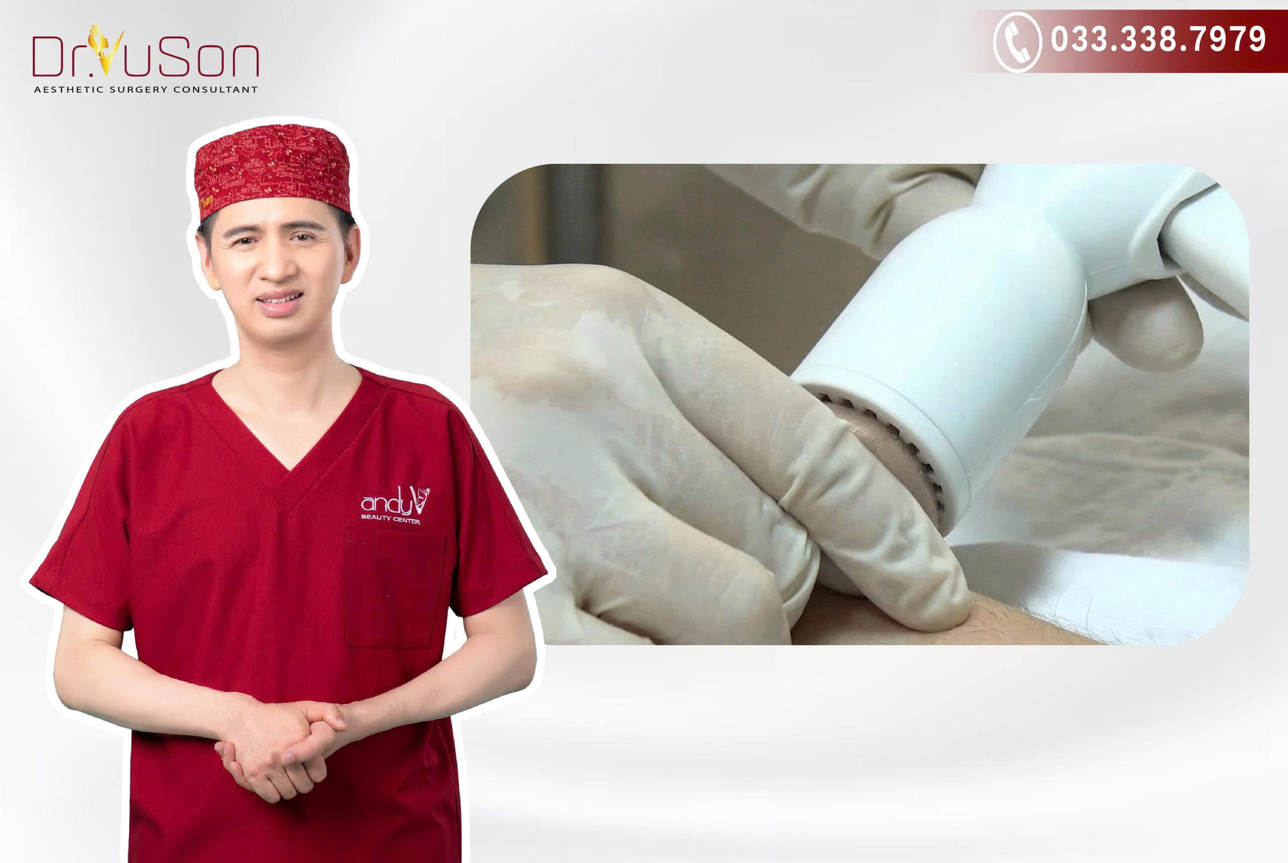 Hình ảnh cận cảnh thiết bị cắt bao quy đầu bằng máy Surkon dùng 1 lần, thiết kế hiện đại giúp thao tác nhanh gọn, vô trùng